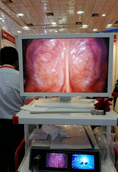 Medical FHD Endoscope Camera Unit