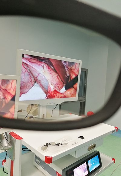 3D Medical Endoscope Monitor 32＂