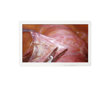 Medical 4K Endoscope Monitor 32＂