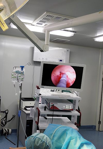 Medical HD Endoscope Monitor 21＂