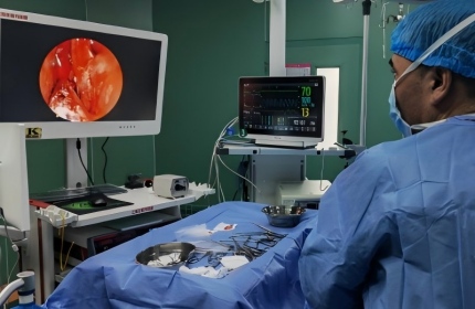 Endoscopic Nasal Polyp Surgery: From Diagnosis and Treatment to Follow-Up
